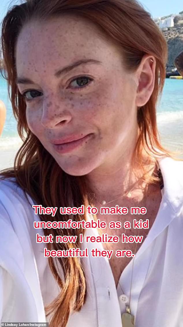 Last year, Lindsay admitted she was insecure about her freckles