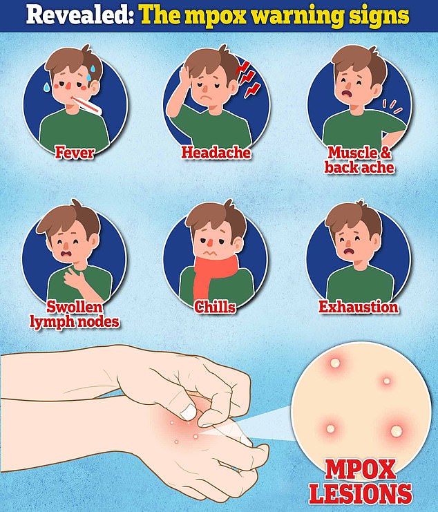 1733149376 114 Expert reveals most commonly overlooked sign of ultra deadly mpox strain