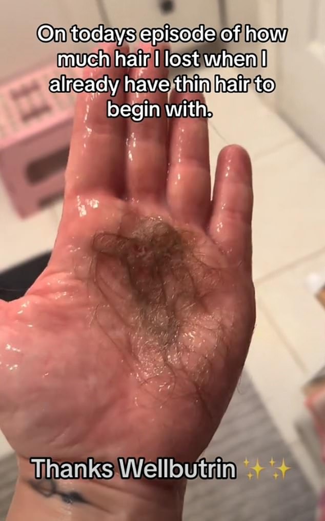 A mother of four uploaded these images to TikTok and said her hair started falling out after using Wellbutrin.