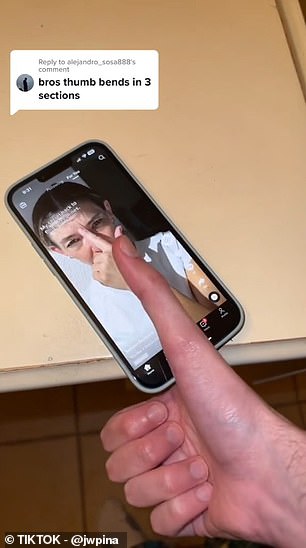 Pina has gone viral on TikTok for her thumb, showing clips comparing it to other objects. The photo above shows him trying to use his cell phone with his thumb extended.