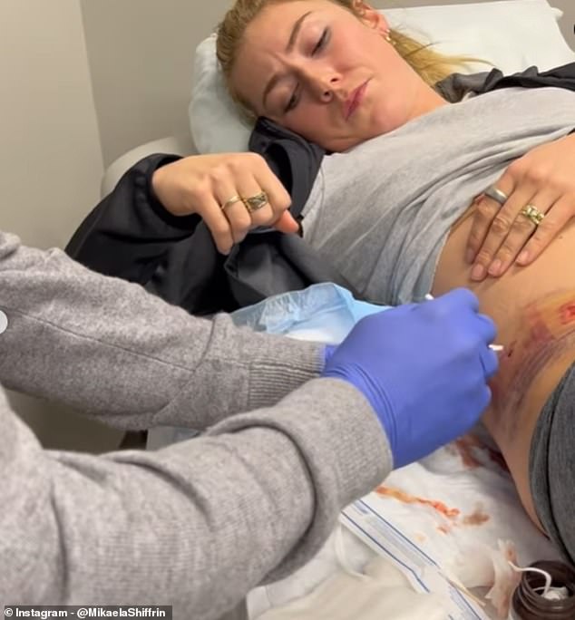 Shiffrin grimaces as a nurse pokes and prods her during her visit to the hospital in Killington