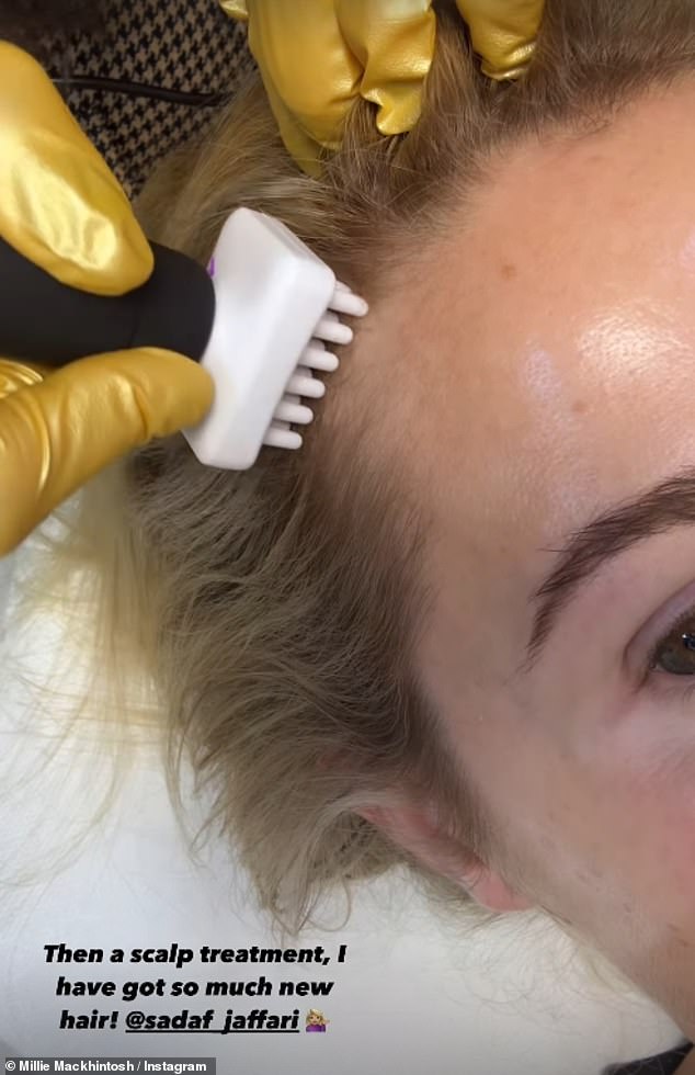 The TV star, 35, shared a clip on Instagram of what appeared to be a scalp massage with a white rubber brush.