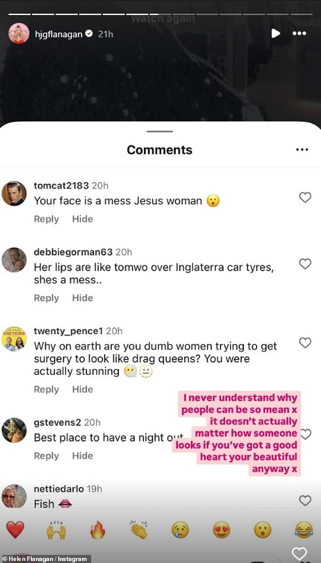 Helen took to her Instagram Stories on Sunday night, where she shared a glimpse of some of the hate comments she received, including one that said her lips looked like a 'baboon a**'.