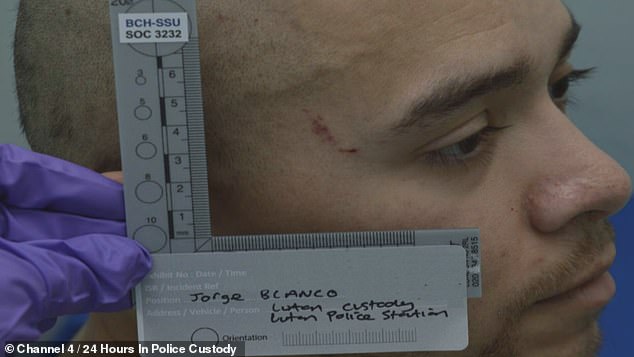 The officers saw that he had scratches on his face, which indicates that someone used self-defense measures.