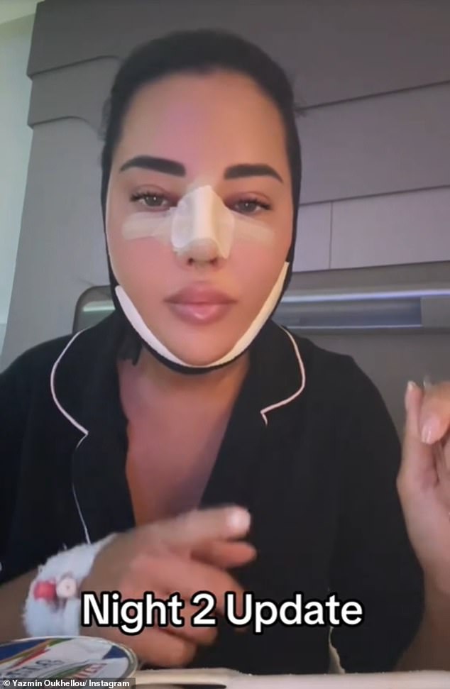 Two weeks ago, Yazmin documented her 'sore' and 'swollen' face on TikTok while she recovered.