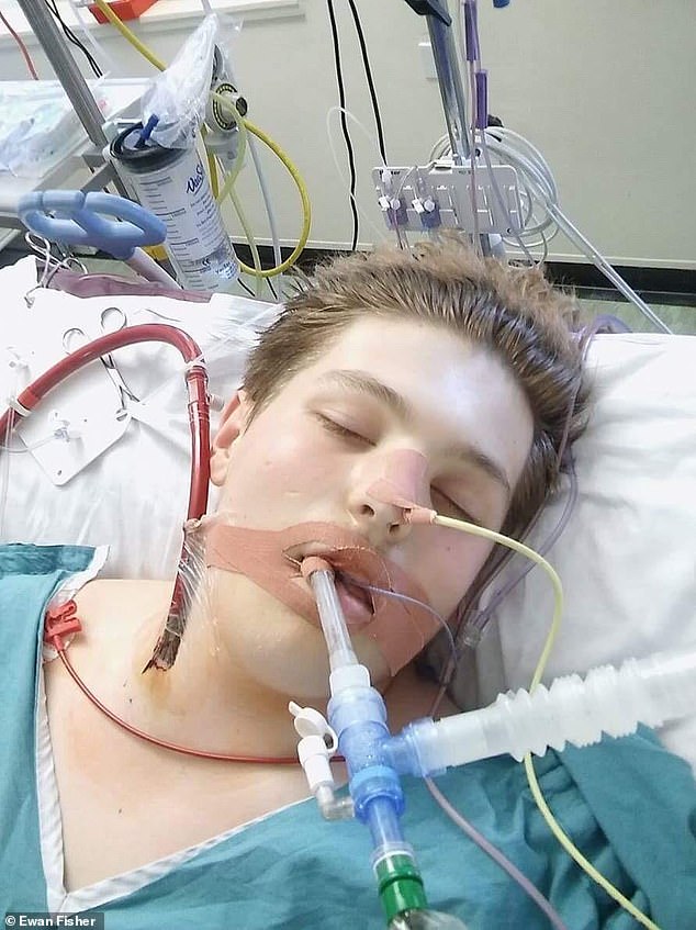 A famous example of a vaping allergy is that of Ewan Fisher, who at the age of 16 almost died due to an extreme reaction in which the alveoli and airways of his lungs became severely inflamed.