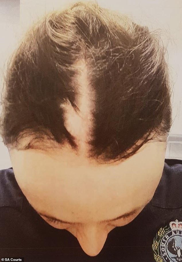 The court heard Cruise launched a violent attack on Constable Anthea Beck outside the Exeter Hotel in Adelaide, leaving the officer with a large section of hair torn from his scalp (pictured).