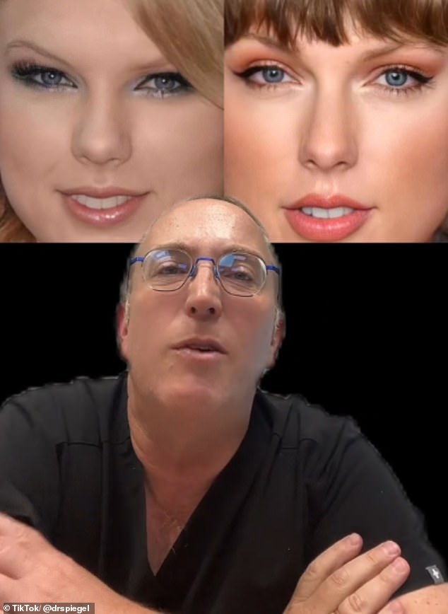 Facial plastic surgeon @drspiegel told his 37,000 followers on TikTok that Taylor now has more visible eyelids due to the surgery.