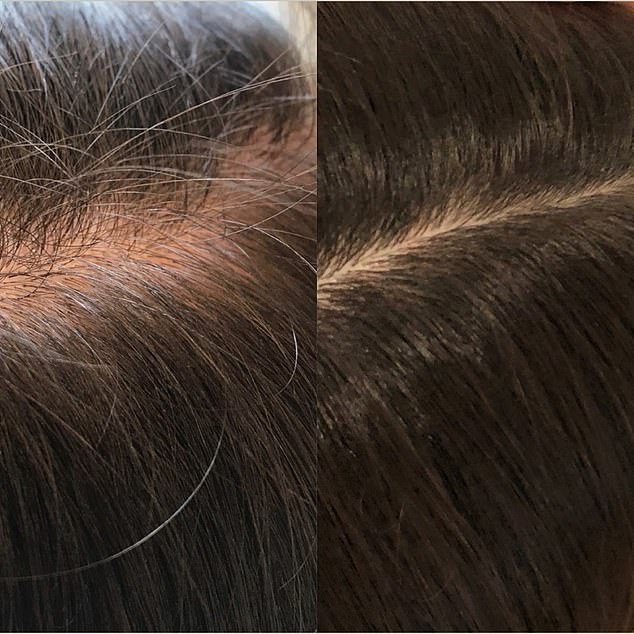 The supplement was created to address a number of hair problems, including thinning, thin or dull hair, and hair loss, and customers have shared impressive results.