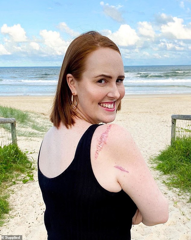 Courtney went for checkups every three months after doctors removed the mole from her shoulder.