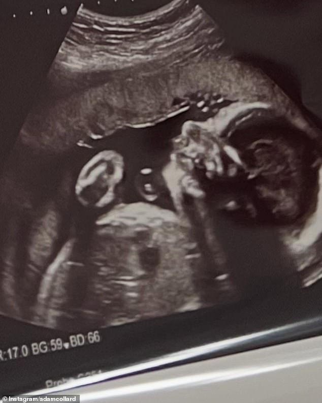 He also shared an image of Laura's last ultrasound.