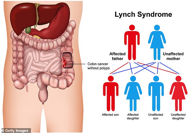 Lynch syndrome significantly increases the risk of numerous cancers early in life