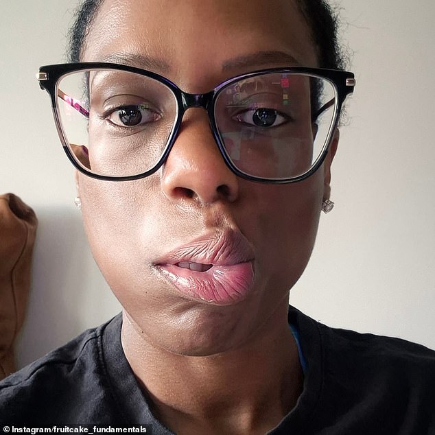 Fruitcake shared a collection of selfies from her battle with Bell's Palsy while giving her fans a glimpse into her recovery.