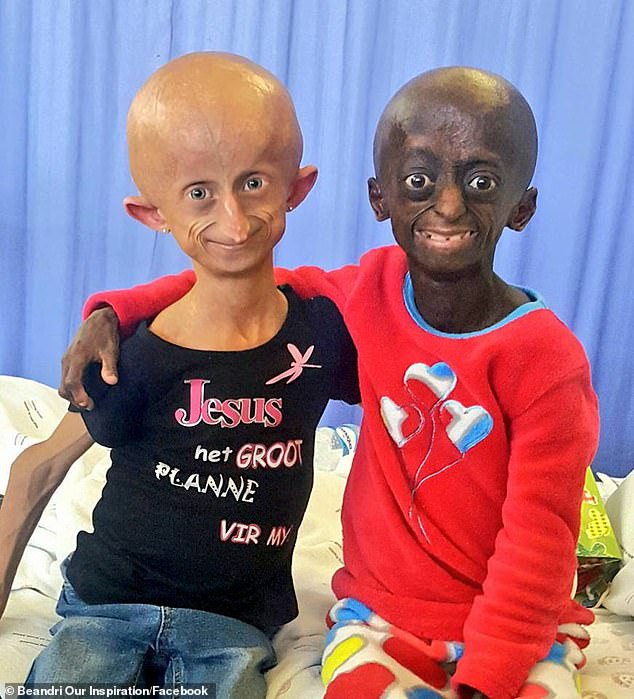 Beanadri with his fellow sufferer Ontlametse Phalatse. The two were close friends before Phalatse died last year from the mutation at age 18 and was the only black person to have it in South Africa.