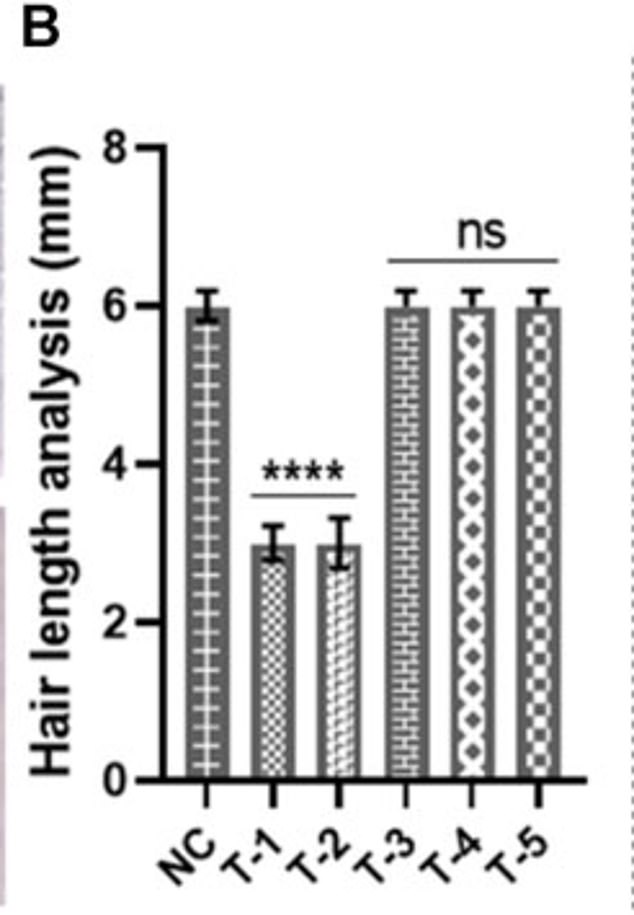 This analysis measures how long hair grew in skin samples from different treatment groups, including the one treated with the experimental gel (T-3). There was a big difference in hair growth between the NC group and the T-1 and T-2. There were no notable differences between the NC group and T-3 (the group treated with the experimental gel) or other treatment groups.