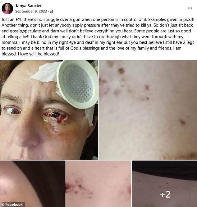 One of Tanya's Facebook posts shows the aftermath after the incident where James Ray allegedly shot her in the eyes, once in the head and four times in the chest, after he became angry with her while drinking.