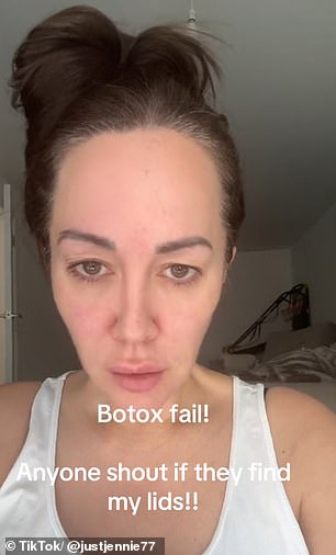 Social media user @justjennie77 shared her Botox Mishap on TikTok to warn others about the possible side effects. The video shows her showing off her slightly drooping eyelids, which she says is a dramatic change from her previously drooping eyelids. 