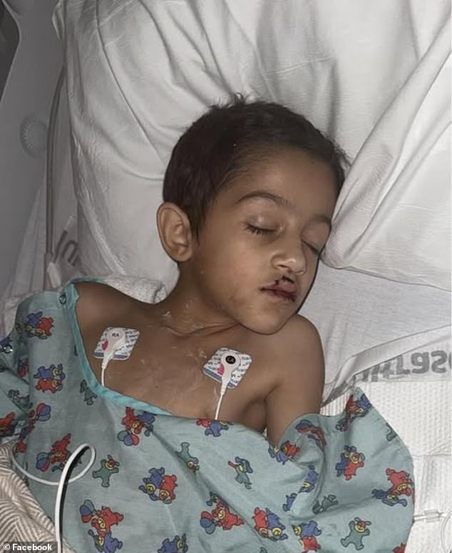 Alexander Edgerton, 7, is pictured in a hospital bed after being hit in the chest and lip by one of the falling drones