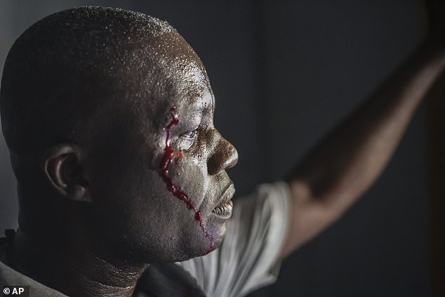 An injured security guard looks on after being shot by armed gangs at the General Hospital