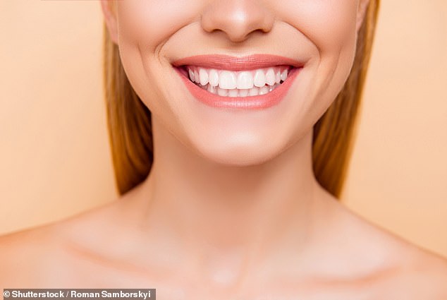 Anna accused people of having veneers 