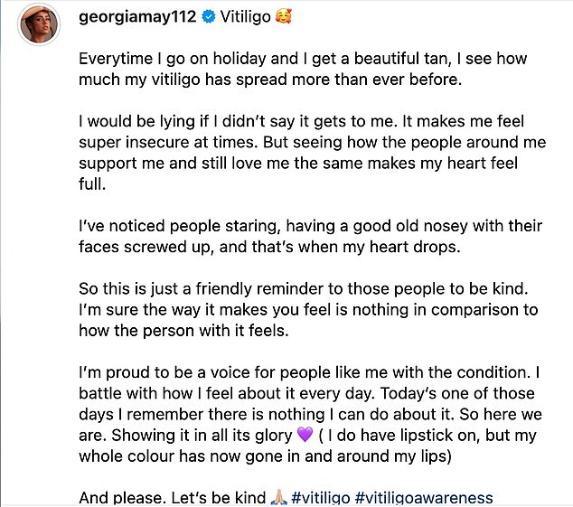 After a holiday in Egypt in May, the Strictly Come Dancing finalist shared a photo of her hands and uploaded a lengthy post urging people to be kind.