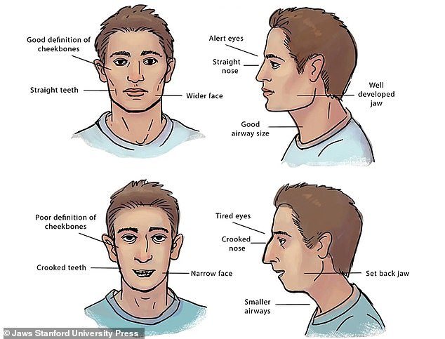 The upper images show a person breathing through the nose and the lower image shows a person breathing through the mouth. According to Dr. Huberman's colleagues Sandra Kahn and Paul R. Ehrlich, who published the book Jaws, breathing through the mouth can cause a receding jaw and tired eyes.