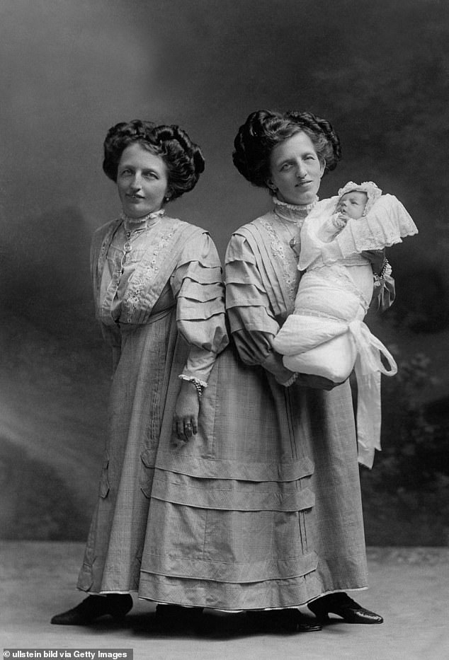 Only one case of successful pregnancy of conjoined twins has been recorded in the medical literature. The 2001 report, prepared by American doctors at the Atlanta Medical Center in Georgia, documented the birth of the Blazek sisters.