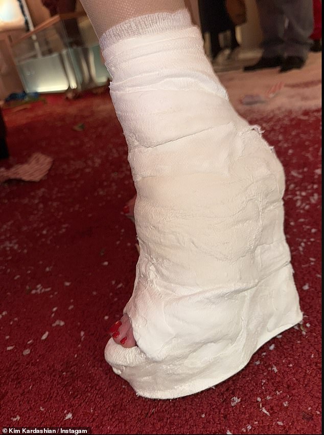 The TV personality went viral when she debuted a heel cast made of gauze and thick plaster that was shaped to look like an open wedge on Instagram this week.