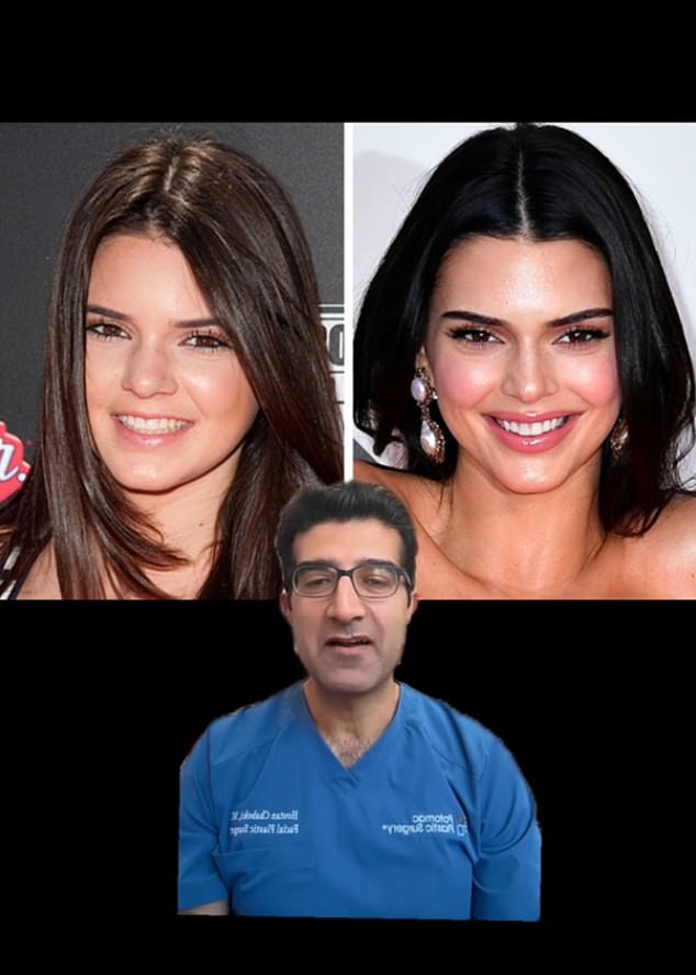 Dr. Houtan Chaboki, a Washington-based facial plastic surgeon, said he suspects Kendall has had nose surgery and lip fillers. In a TikTok video he said he felt 