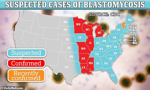 The map above shows states where cases of blastomycosis have been confirmed (red), recently confirmed (orange), or suspected (blue).