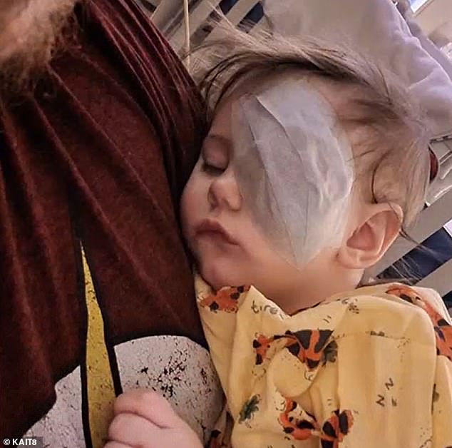 Doctors had to remove Lily's left eye. In about eight weeks, he will have a prosthetic eye fitted while he undergoes chemotherapy.