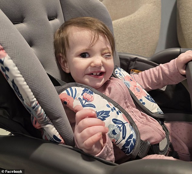 Lily, 1, is pictured after her first day of chemotherapy to shrink tumors in her right eye. Doctors believe there is a high probability of saving him.