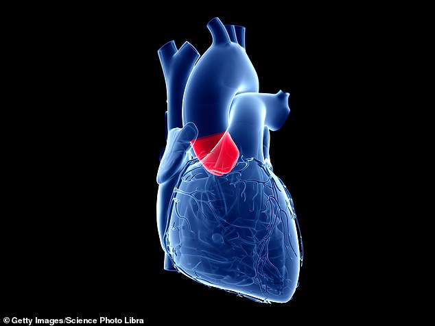 Research published in Nature Communications Biology showed promising results in sheep. In the photo: Illustration of the aortic valve.