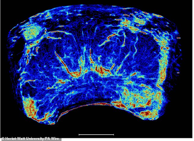 Prostate cancer imaging developed by university researchers has shown results 