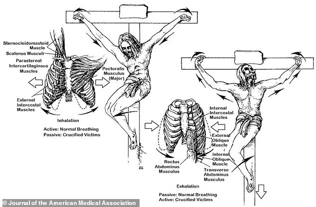 A 1986 study determined that Jesus died from asphyxiation due to exhaustion.